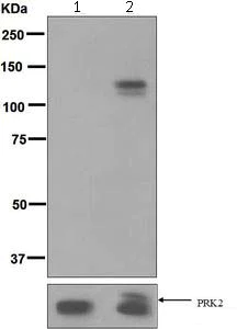 Western blot - Anti-PKN3 (phospho T718) + PRK1 (phospho T774) + PKN2 (phospho T816) antibody [EPR5671] (AB124709)