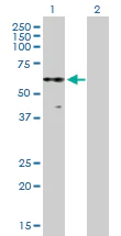 Western blot - Anti-PKNOX2 antibody (AB169458)