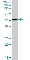 Western blot - Anti-PKNOX2 antibody (AB169458)