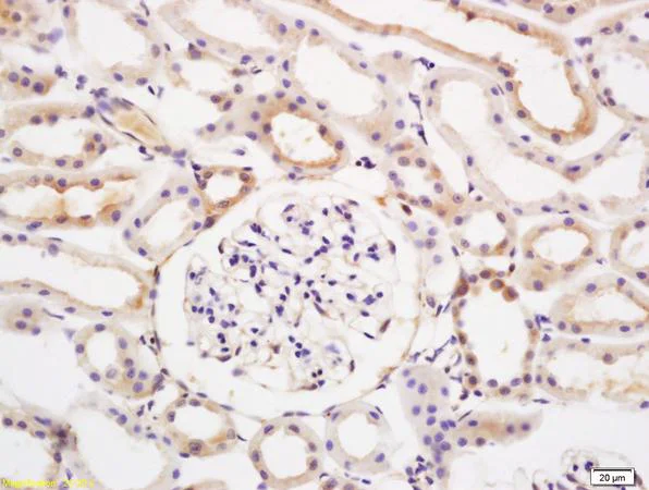 Immunohistochemistry (Formalin/PFA-fixed paraffin-embedded sections) - Anti-PKR antibody (AB217294)