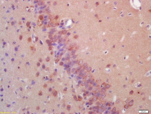 Immunohistochemistry (Formalin/PFA-fixed paraffin-embedded sections) - Anti-PKR antibody (AB217294)