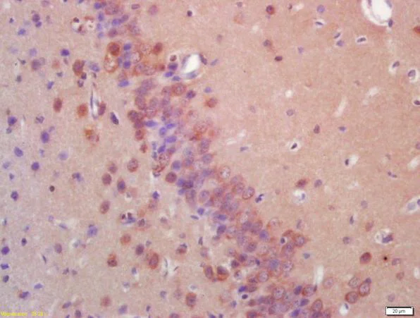 Immunohistochemistry (Formalin/PFA-fixed paraffin-embedded sections) - Anti-PKR antibody (AB217294)