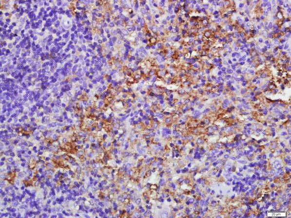 Immunohistochemistry (Formalin/PFA-fixed paraffin-embedded sections) - Anti-PKR antibody (AB217294)