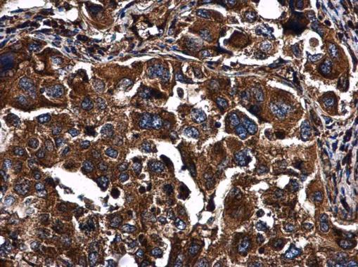 Immunohistochemistry (Formalin/PFA-fixed paraffin-embedded sections) - Anti-PKR antibody (AB226819)