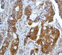 Immunohistochemistry (Formalin/PFA-fixed paraffin-embedded sections) - Anti-PKR antibody [Y117] (AB32506)