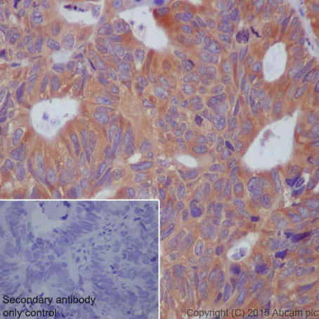 Immunohistochemistry (Formalin/PFA-fixed paraffin-embedded sections) - Anti-PKR antibody [Y117] (AB32506)