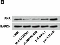 Western blot - Anti-PKR antibody [Y117] (ab32506), expandable thumbnail