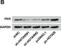 Western blot - Anti-PKR antibody [Y117] (AB32506)