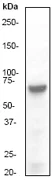 Western blot - Anti-PKR antibody [Y117] (AB32506)