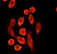 Immunocytochemistry/ Immunofluorescence - Anti-PKR antibody [Y117] - BSA and Azide free (AB239817)
