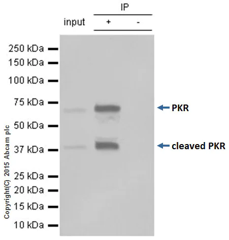 Immunoprecipitation - Anti-PKR antibody [Y117] - BSA and Azide free (AB239817)