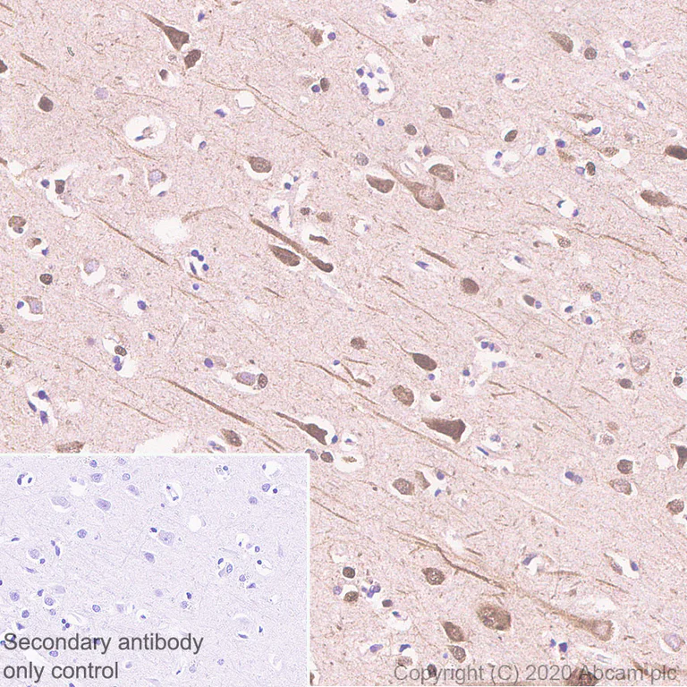 Immunohistochemistry (Formalin/PFA-fixed paraffin-embedded sections) - Anti-PKR antibody [YE350] - BSA and Azide free (AB239799)
