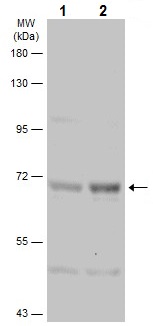 Western blot - Anti-PKR (phospho T446) antibody (AB226852)