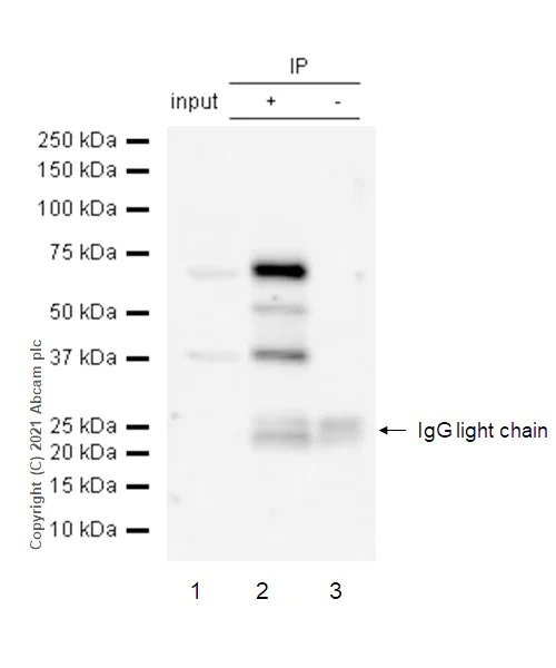Immunoprecipitation - Anti-PKR (phospho T446) antibody [E120] (AB32036)