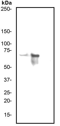 Western blot - Anti-PKR (phospho T446) antibody [E120] (AB32036)