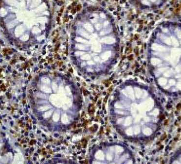 Immunohistochemistry (Formalin/PFA-fixed paraffin-embedded sections) - Anti-PKR (phospho T446) antibody [E120] - BSA and Azide free (AB220801), expandable thumbnail