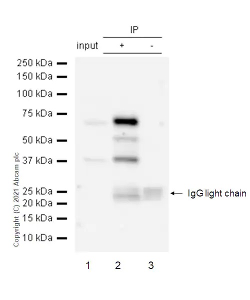 Immunoprecipitation - Anti-PKR (phospho T446) antibody [E120] - BSA and Azide free (AB220801), expandable thumbnail