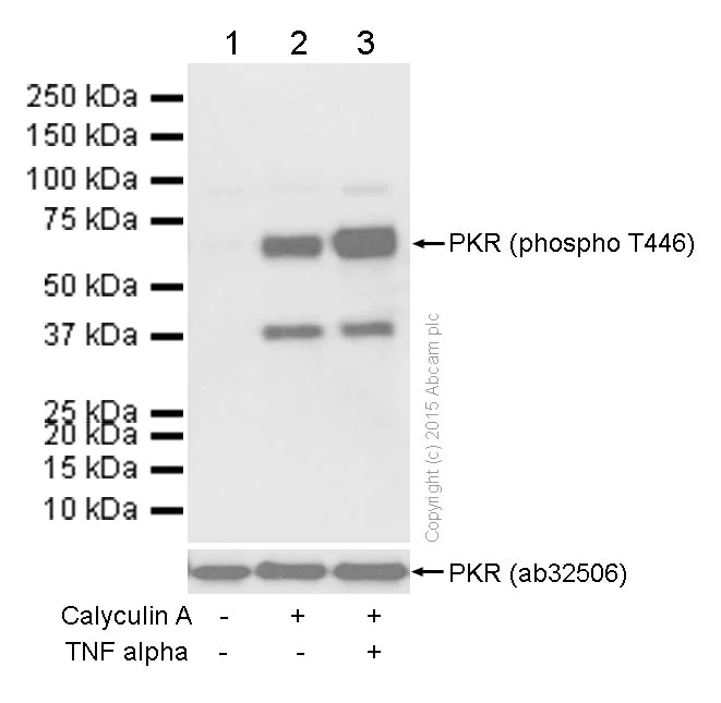 Western blot - Anti-PKR (phospho T446) antibody [E120] - BSA and Azide free (AB220801)
