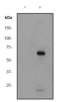 Western blot - Anti-PKR (phospho T451) antibody [EPR2152Y] (AB81303)