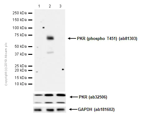 Western blot - Anti-PKR (phospho T451) antibody [EPR2152Y] (AB81303)