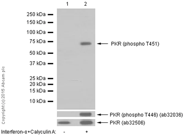 Western blot - Anti-PKR (phospho T451) antibody [EPR2152Y] - BSA and Azide free (AB227983)