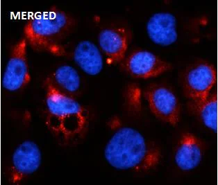 Immunocytochemistry/ Immunofluorescence - Anti-PKR (phospho T451) antibody [SR4377] (AB326705)