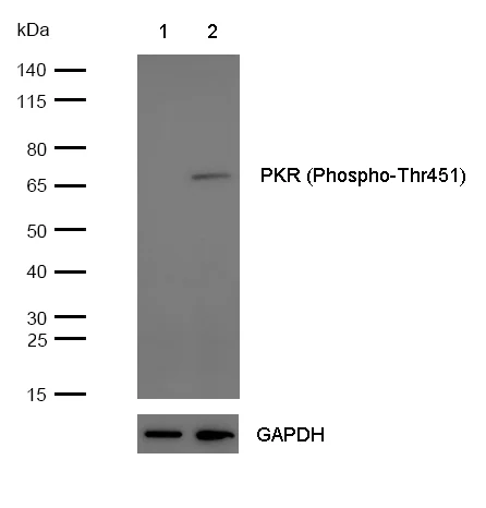 Western blot - Anti-PKR (phospho T451) antibody [SR4377] (AB326705)