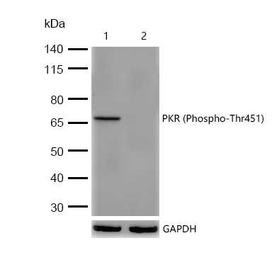 Western blot - Anti-PKR (phospho T451) antibody [SR4377] (AB326705)