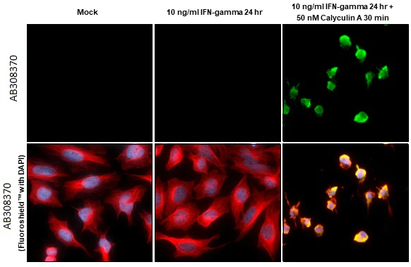 Immunocytochemistry/ Immunofluorescence - Anti-PKR phospho Thr446 antibody [HL1439] (AB308370)