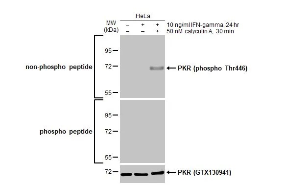 Western blot - Anti-PKR phospho Thr446 antibody [HL1439] (AB308370), expandable thumbnail