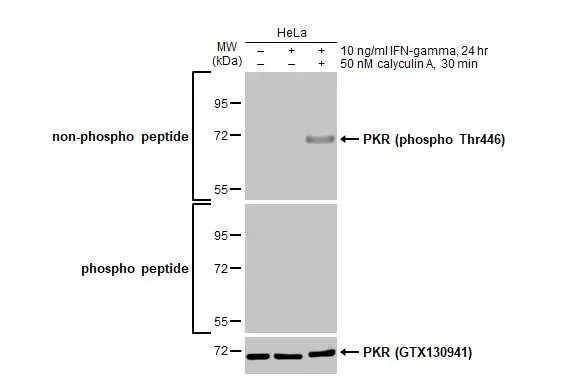 Western blot - Anti-PKR phospho Thr446 antibody [HL1439] (AB308370)