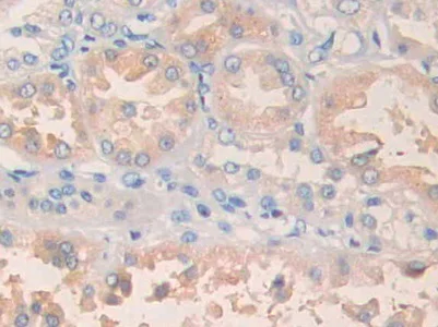 Immunohistochemistry (Formalin/PFA-fixed paraffin-embedded sections) - Anti-PLA1A/NMD antibody (AB233145)