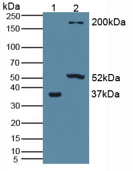Western blot - Anti-PLA1A/NMD antibody (AB233145)