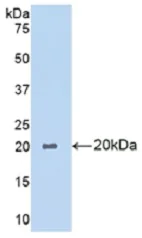 Western blot - Anti-PLA1A/NMD antibody (AB233145)