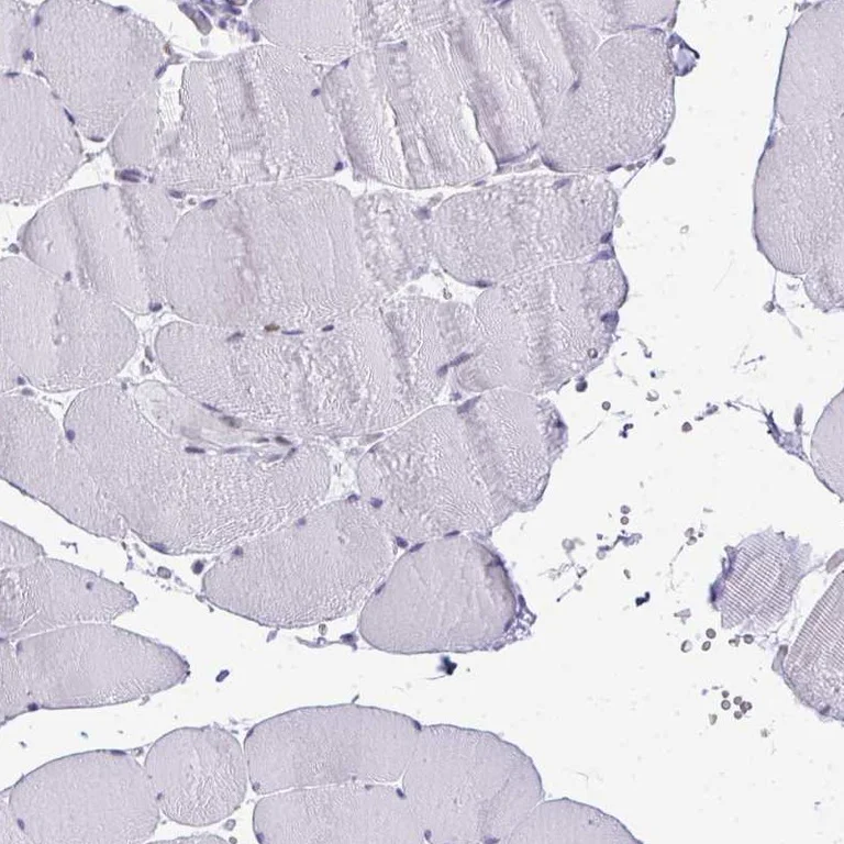 Immunohistochemistry (Formalin/PFA-fixed paraffin-embedded sections) - Anti-PLA2G1B antibody (AB262882)