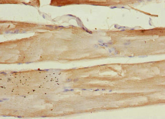 Immunohistochemistry (Formalin/PFA-fixed paraffin-embedded sections) - Anti-PLA2G4C antibody (AB230250)