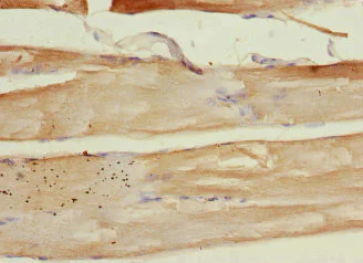 Immunohistochemistry (Formalin/PFA-fixed paraffin-embedded sections) - Anti-PLA2G4C antibody (AB230250)