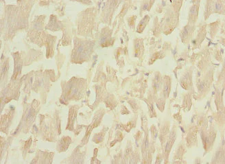 Immunohistochemistry (Formalin/PFA-fixed paraffin-embedded sections) - Anti-PLA2G4C antibody (AB230250)