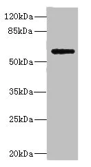 Western blot - Anti-PLA2G4C antibody (AB230250)
