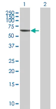 Western blot - Anti-PLA2G4C antibody (AB67649)