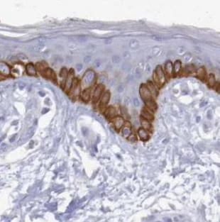 Immunohistochemistry (Formalin/PFA-fixed paraffin-embedded sections) - Anti-PLA2G4E antibody (AB188438)