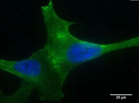 Immunocytochemistry/ Immunofluorescence - Anti-PLA2R antibody [12-6-5] (AB211490)