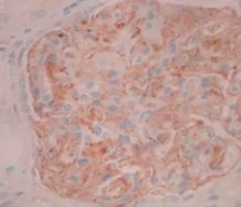 Immunohistochemistry (Formalin/PFA-fixed paraffin-embedded sections) - Anti-PLA2R antibody [12-6-5] (AB211490)