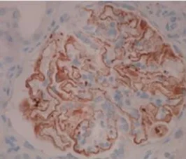 Immunohistochemistry (Formalin/PFA-fixed paraffin-embedded sections) - Anti-PLA2R antibody [12-6-5] (AB211490)