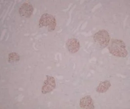 Immunohistochemistry (Formalin/PFA-fixed paraffin-embedded sections) - Anti-PLA2R antibody [12-6-5] (AB211490)