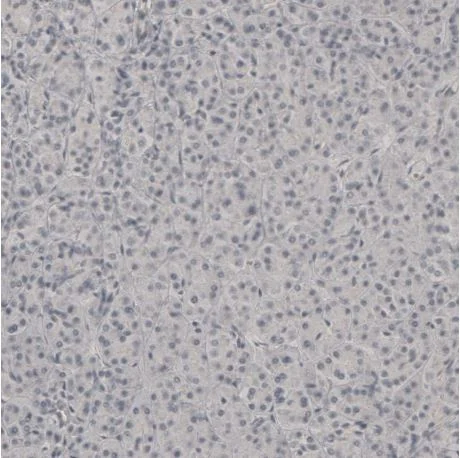Immunohistochemistry (Formalin/PFA-fixed paraffin-embedded sections) - Anti-PLA2R antibody (AB194256)