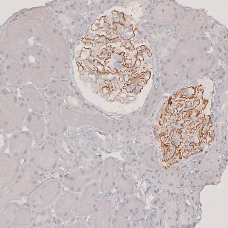 Immunohistochemistry (Formalin/PFA-fixed paraffin-embedded sections) - Anti-PLA2R antibody (AB194256)