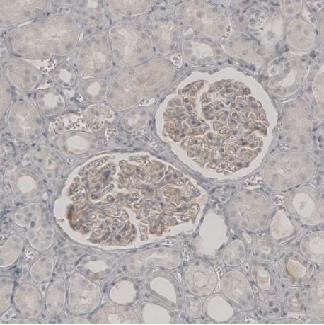 Immunohistochemistry (Formalin/PFA-fixed paraffin-embedded sections) - Anti-PLA2R antibody (AB194256)