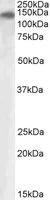 Western blot - Anti-PLA2R antibody (AB99466)