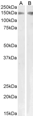 Western blot - Anti-PLA2R antibody (AB99466)